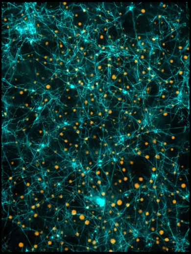 ‘PGL-3 Condensates in a Fibrin Network’, gemaakt door Ali Sentissi uit de onderzoeksgroep van Louise Jawerth